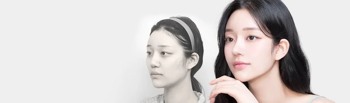 AB前后照片
