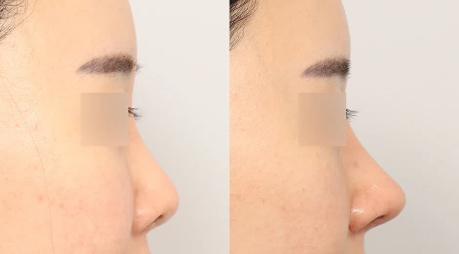 AB Plastic Surgery