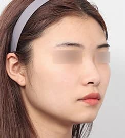 手术前