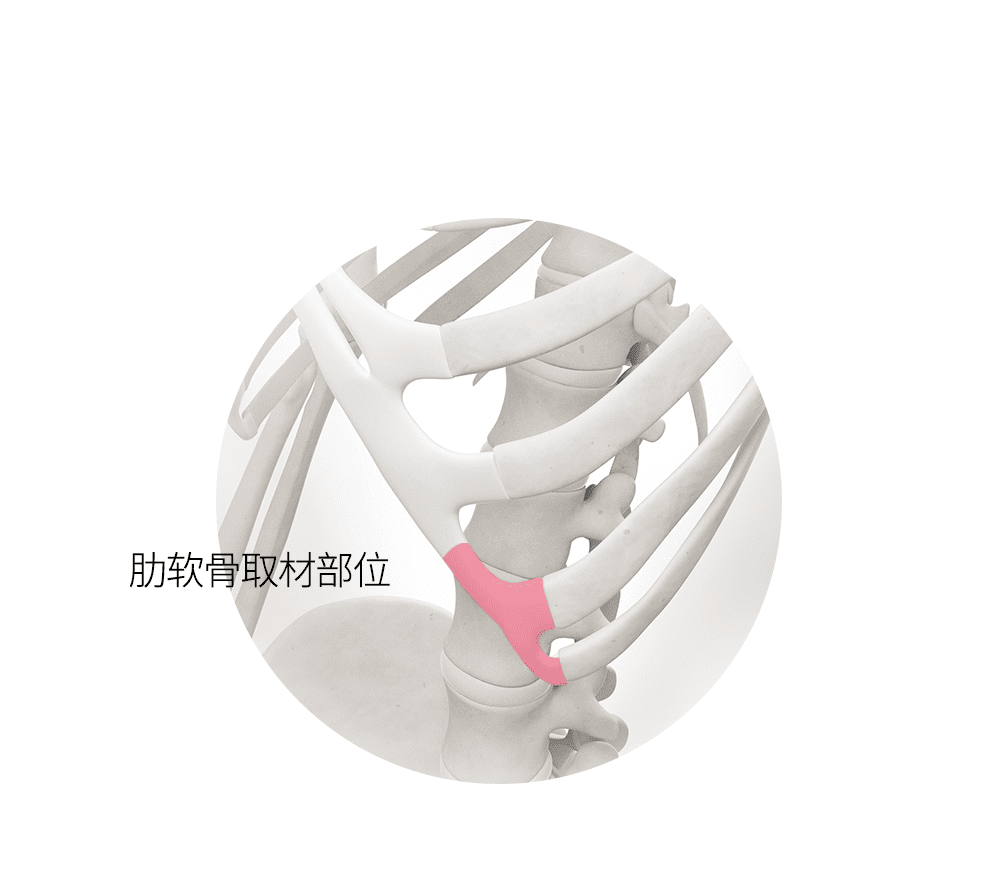 肋软骨取材