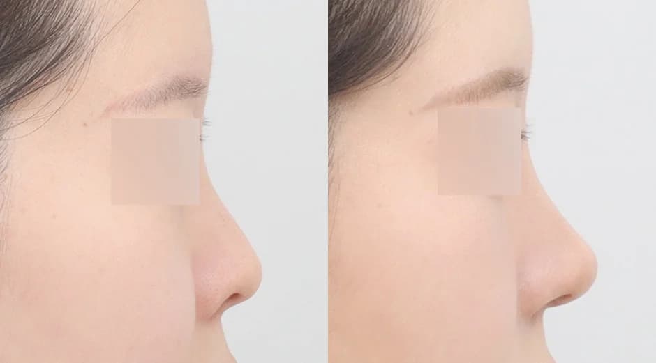 AB Plastic Surgery