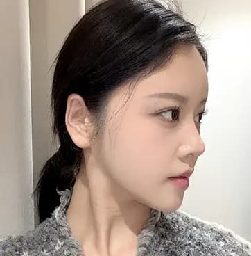 术后3个月