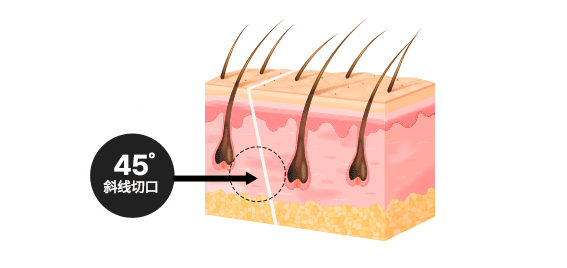 AB Key feature