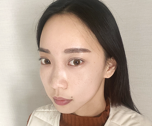 额头缩小 | 面部轮廓整形 | AB整形外科