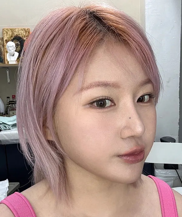术后78天