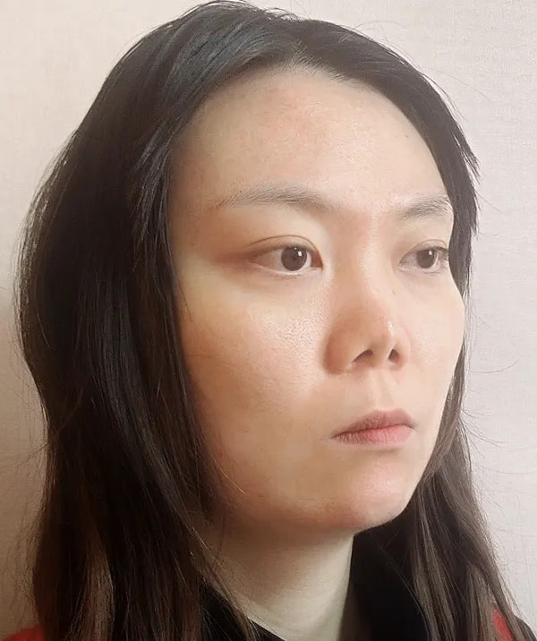手术前