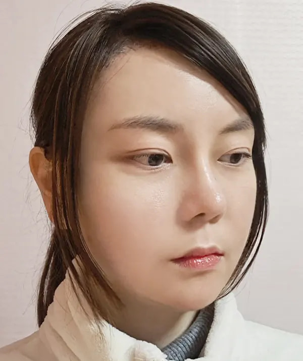 术后60天