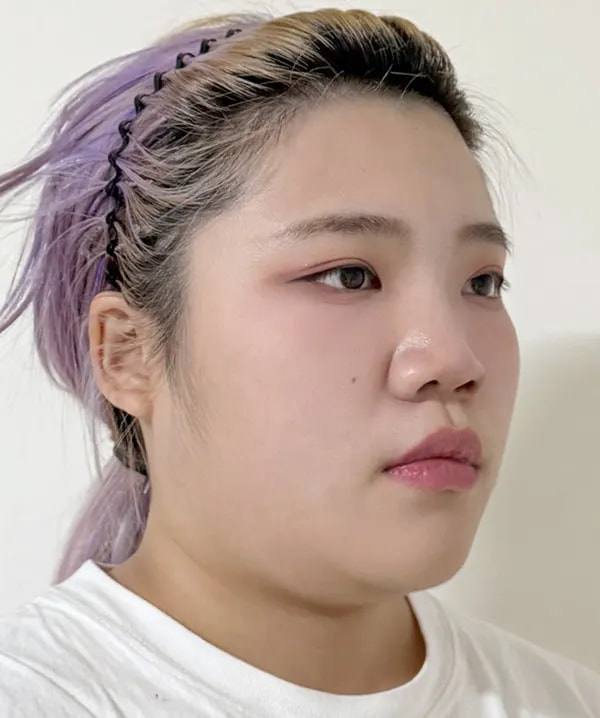 手术前