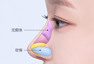 驼峰鼻整形 — step 2