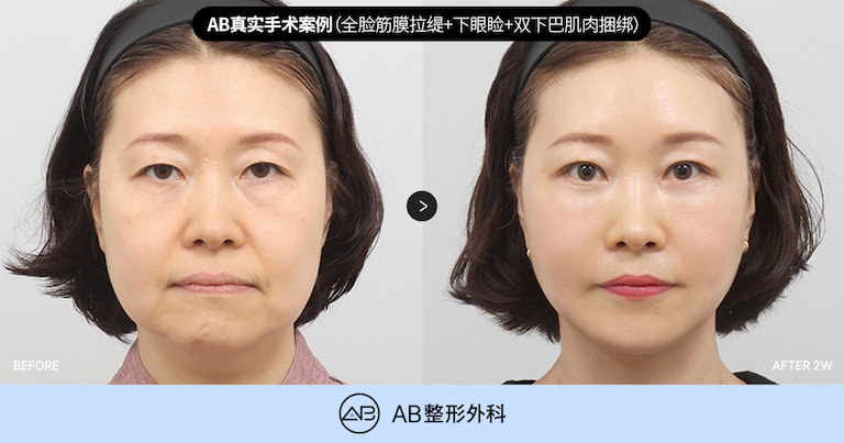AB Plastic Surgery