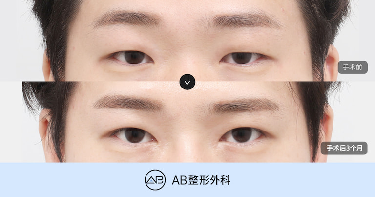 AB Plastic Surgery