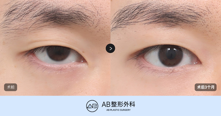 AB Plastic Surgery