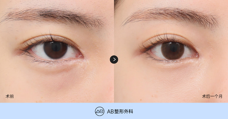 AB Plastic Surgery