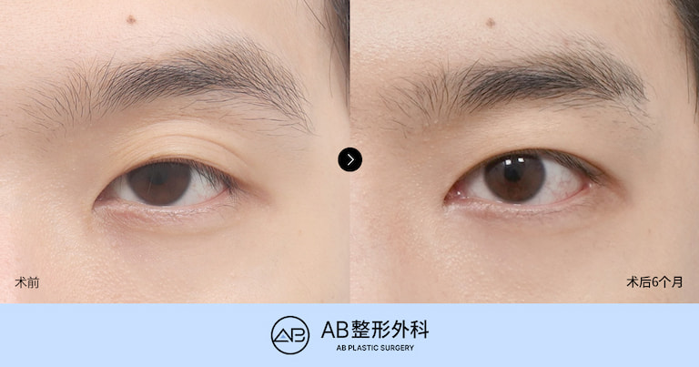 AB Plastic Surgery