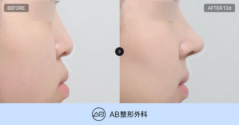 AB Plastic Surgery
