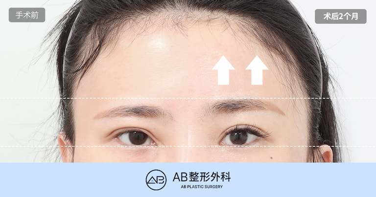 AB Plastic Surgery