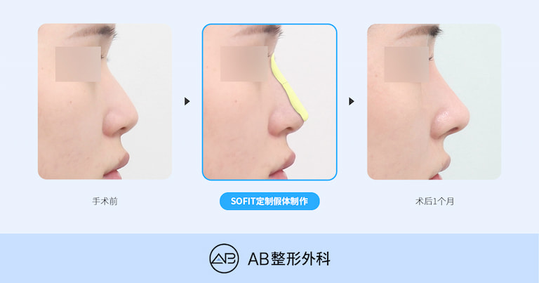 AB Plastic Surgery