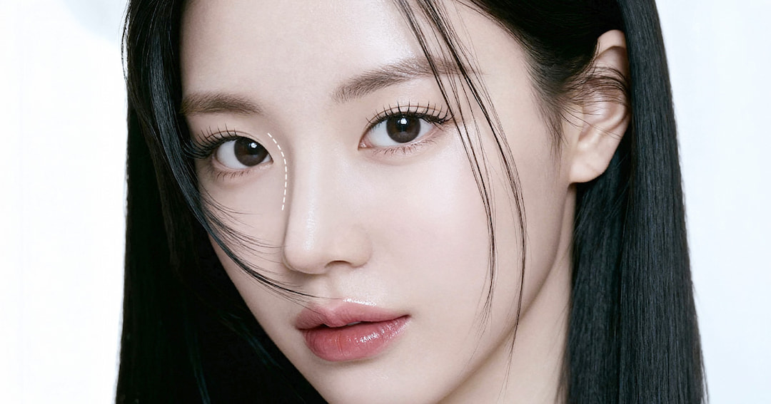 驼峰鼻修复：为什么第一次手术后鼻梁还是凸？二次修复关键解析