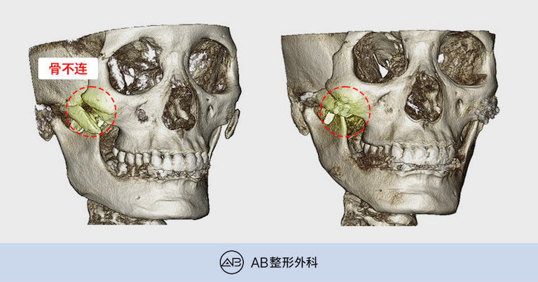 AB Plastic Surgery