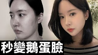 像宋慧喬一樣擁有蛋形臉 | 整形前後對比