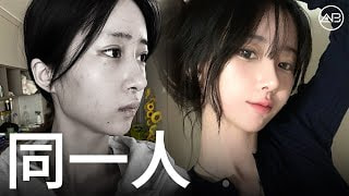 [韓國整形] 韓國整形2個月後！眼鼻輪廓的驚人結果 