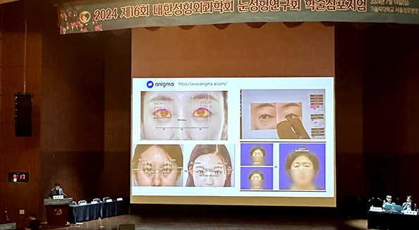 APS 眼部整形研究会、眼部整形研究会学术研讨会等，国内外学会及论文发表活动