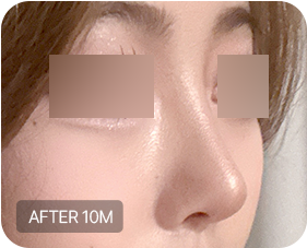 Before and after 4-3