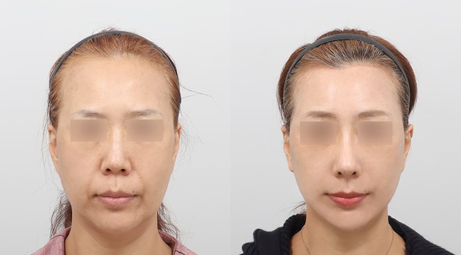 AB Plastic Surgery