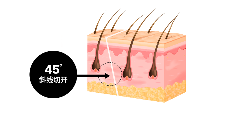 AB’s Key feature