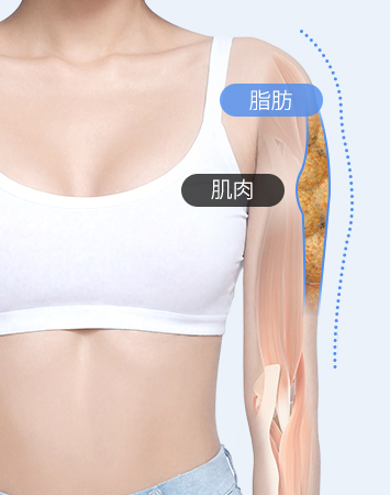 Fat and muscle before precise diagnosis