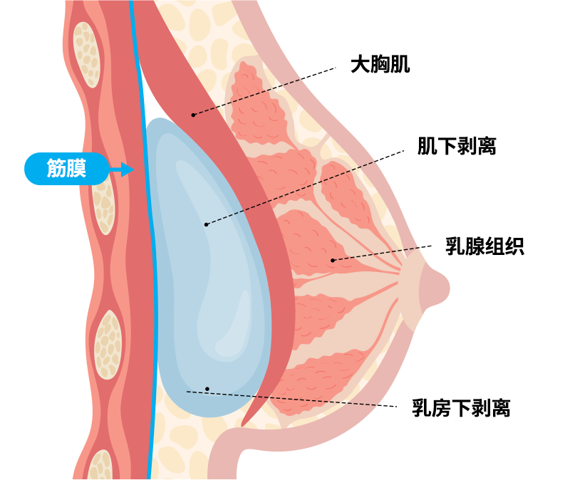 双平面法