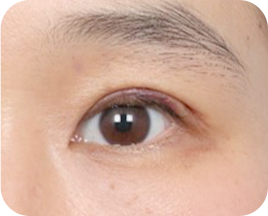 The Key to Beautiful Eyes