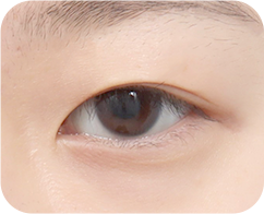 The Key to Beautiful Eyes