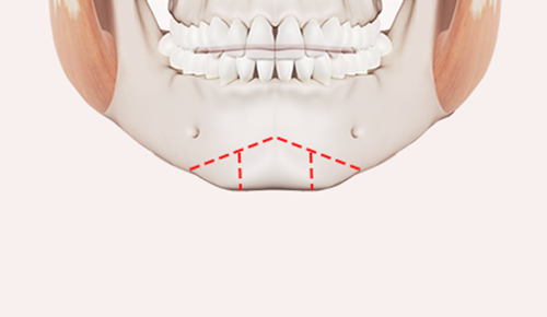 surgery_illust