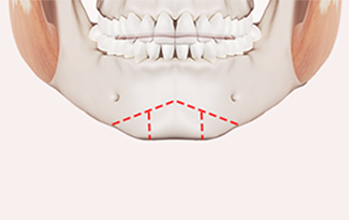 surgery_illust