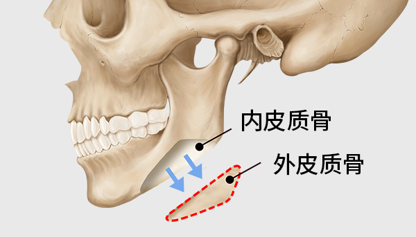 surgery_illust