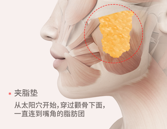 更精致，去除夹脂垫