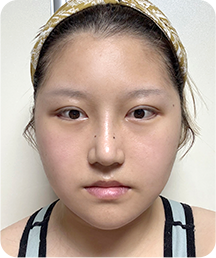 맥미걸 악플콜렉터 Before후 사진