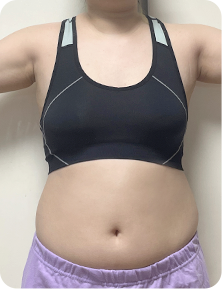 맥미걸 악플콜렉터 Before후 사진