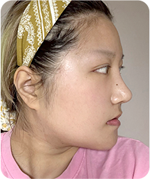 맥미걸 악플콜렉터 Before후 사진