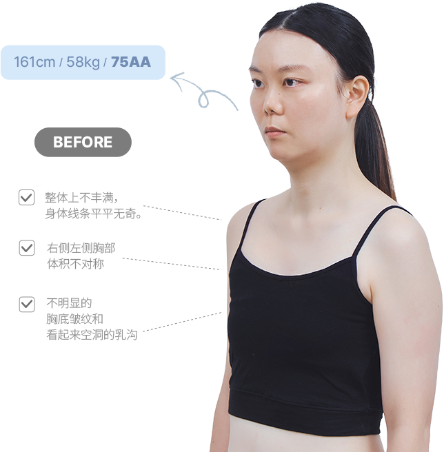 맥미걸 악플콜렉터 바디 수술 전 문제점과 개선점