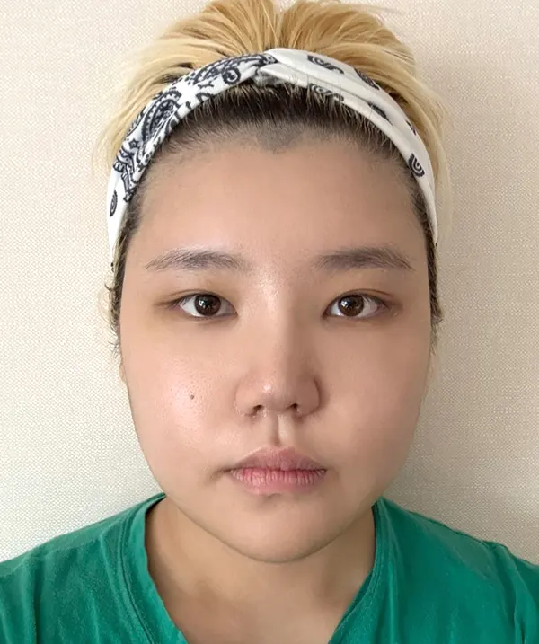 맥미걸 악플콜렉터 Before후 사진