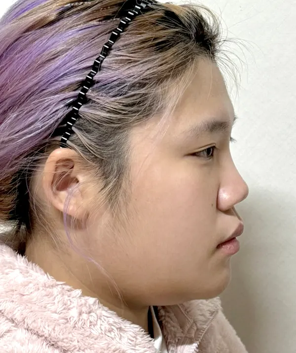 맥미걸 악플콜렉터 Before후 사진