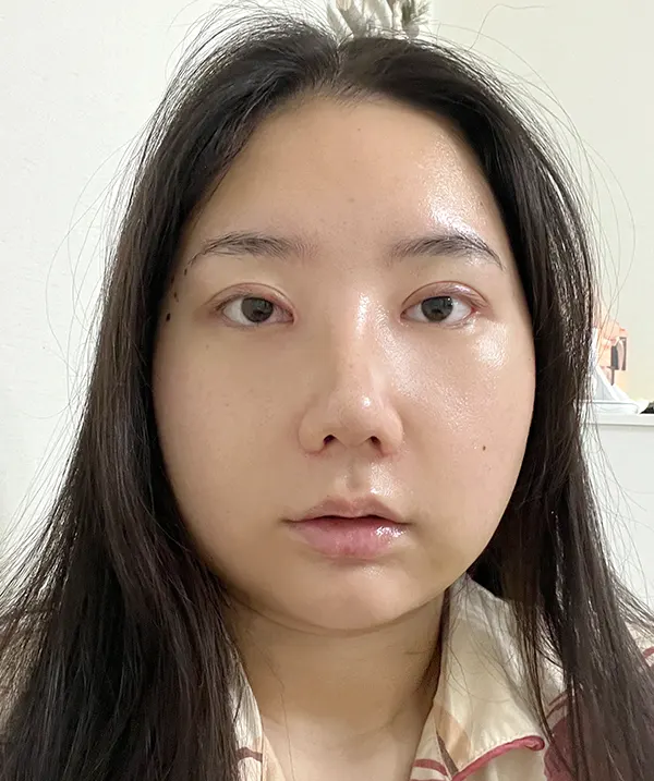 맥미걸 악플콜렉터 Before후 사진