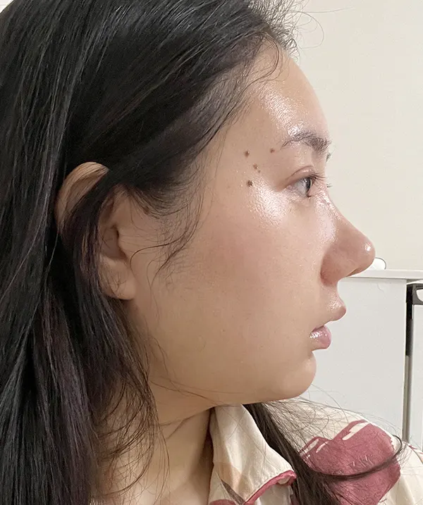 맥미걸 악플콜렉터 Before후 사진