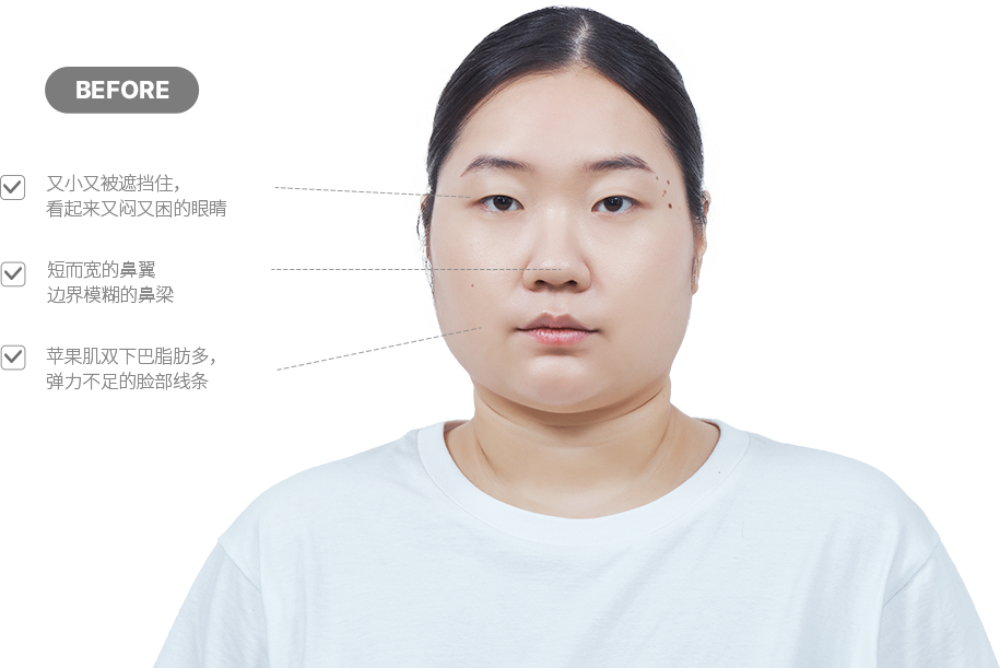 맥미걸 악플콜렉터 얼굴 수술 전 문제점과 개선점