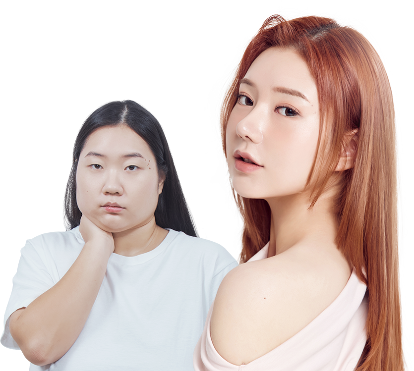 맥미걸 악플콜렉터 수술 전후 사진