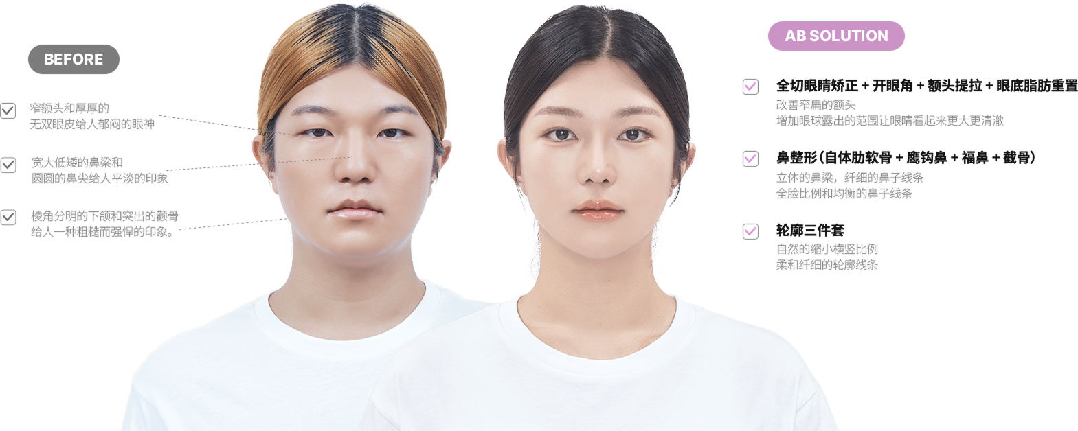 맥미걸 악플콜렉터 얼굴 수술 전 문제점과 개선점