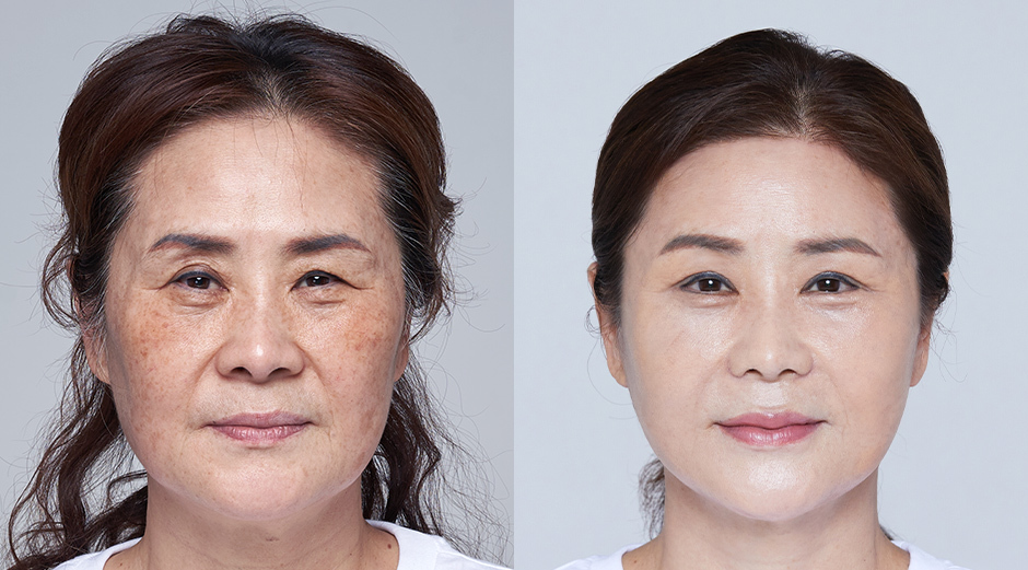 AB Plastic Surgery