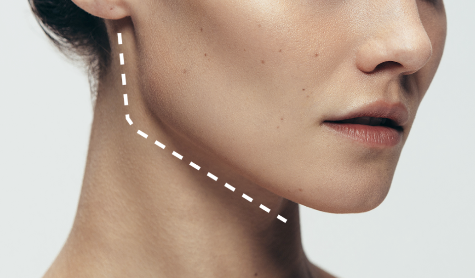 韓國AB整形外科 V臉手術 常見問題（7問7答）